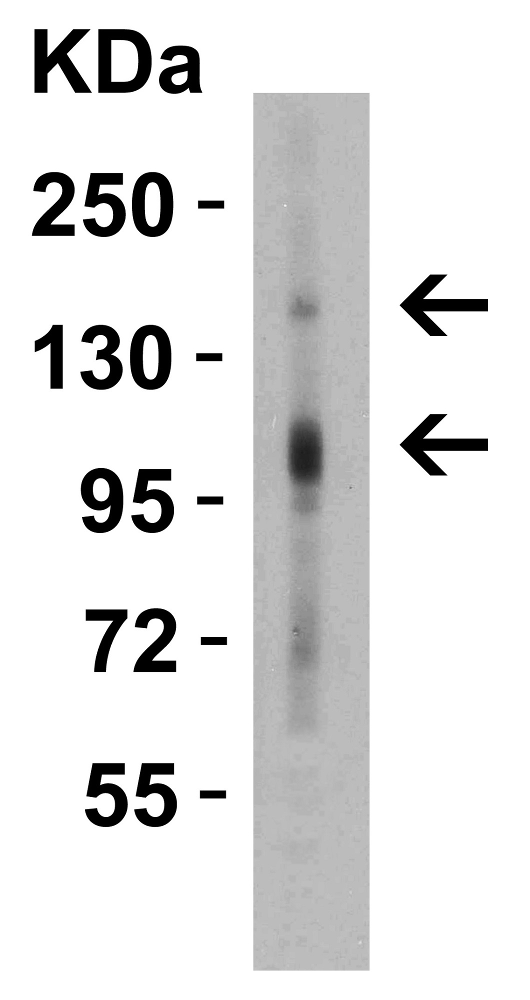 Western blot - Anti-CRB2 antibody (AB156286)