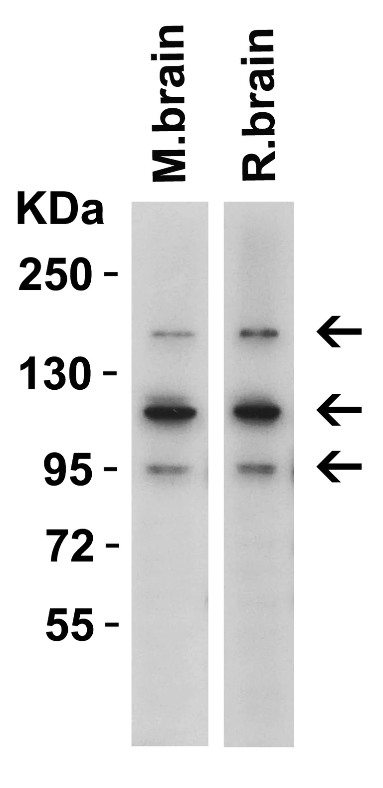 Western blot - Anti-CRB2 antibody (AB156286)