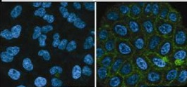 Immunocytochemistry/ Immunofluorescence - Anti-CRB3 antibody [14F9] (AB180835)