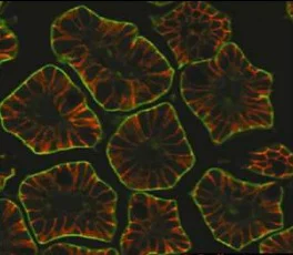 Immunocytochemistry/ Immunofluorescence - Anti-CRB3 antibody [14F9] (AB180835)