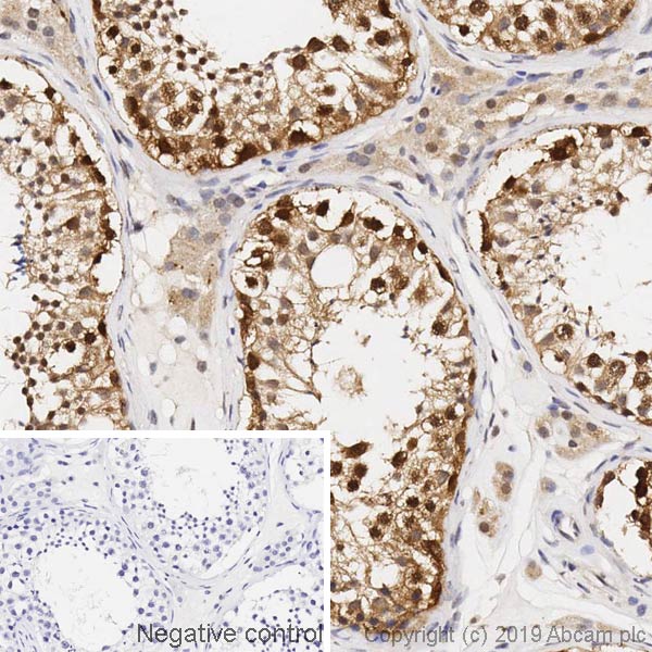 Immunohistochemistry (Formalin/PFA-fixed paraffin-embedded sections) - Anti-CRBN antibody [4D6] - BSA and Azide free (AB252776), expandable thumbnail