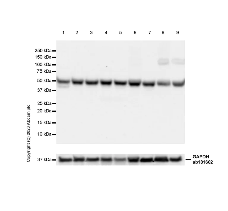 Western blot - Anti-CRBN antibody [EPR28739-64] - BSA and Azide free (AB315345)
