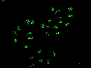 Immunocytochemistry/ Immunofluorescence - Anti-CRCP antibody [EPR9670(B)] (AB139264)