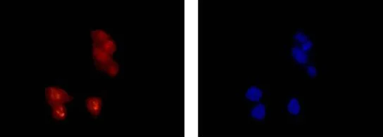 Immunocytochemistry/ Immunofluorescence - Anti-CRCP antibody [EPR9670(B)] - BSA and Azide free (AB248873)