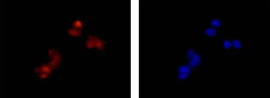 Immunocytochemistry/ Immunofluorescence - Anti-CRCP antibody [EPR9670(B)] - BSA and Azide free (AB248873)