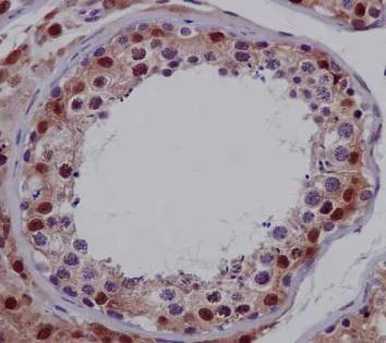 Immunohistochemistry (Formalin/PFA-fixed paraffin-embedded sections) - Anti-CRCP antibody [EPR9670(B)] - BSA and Azide free (AB248873)
