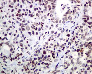 Immunohistochemistry (Formalin/PFA-fixed paraffin-embedded sections) - Anti-CRCP antibody [EPR9670(B)] - BSA and Azide free (AB248873)
