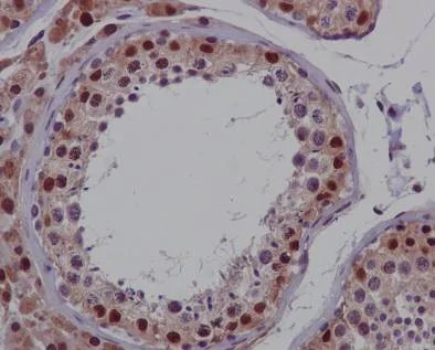 Immunohistochemistry (Formalin/PFA-fixed paraffin-embedded sections) - Anti-CRCP antibody [EPR9670(B)] - BSA and Azide free (AB248873)