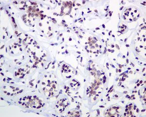 Immunohistochemistry (Formalin/PFA-fixed paraffin-embedded sections) - Anti-CRCP antibody [EPR9670(B)] - BSA and Azide free (AB248873)