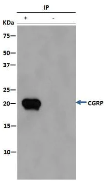 Immunoprecipitation - Anti-CRCP antibody [EPR9670(B)] - BSA and Azide free (AB248873)
