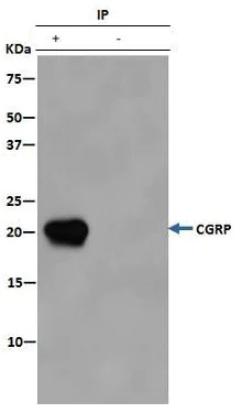 Immunoprecipitation - Anti-CRCP antibody [EPR9670(B)] - BSA and Azide free (AB248873)