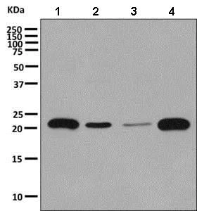 Western blot - Anti-CRCP antibody [EPR9670(B)] - BSA and Azide free (AB248873)