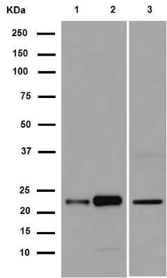 Western blot - Anti-CRCP antibody [EPR9670(B)] - BSA and Azide free (AB248873)