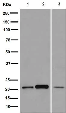 Western blot - Anti-CRCP antibody [EPR9670(B)] - BSA and Azide free (AB248873)
