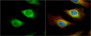 Immunocytochemistry/ Immunofluorescence - Anti-Creatine kinase B type antibody (AB151579)