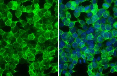 Immunocytochemistry/ Immunofluorescence - Anti-Creatine kinase B type antibody (AB151579)