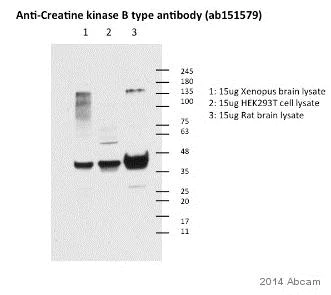 Western blot - Anti-Creatine kinase B type antibody (AB151579)