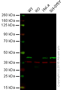 Western blot - Anti-Creatine kinase B type antibody [CK-BYK/21E10] (AB125114)