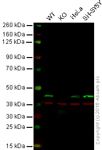 Western blot - Anti-Creatine kinase B type antibody [CK-BYK/21E10] (AB125114)