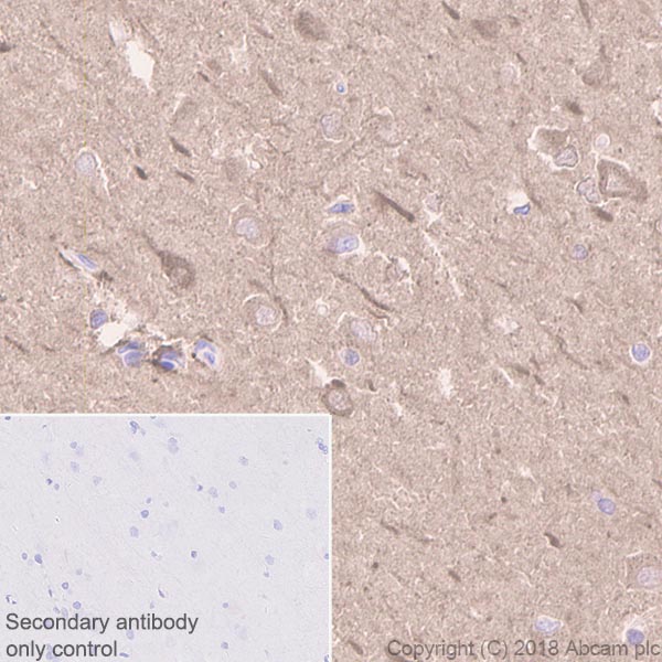 Immunohistochemistry (Formalin/PFA-fixed paraffin-embedded sections) - Anti-Creatine kinase B type antibody [EPR3926] (AB108388), expandable thumbnail