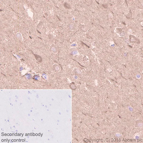 Immunohistochemistry (Formalin/PFA-fixed paraffin-embedded sections) - Anti-Creatine kinase B type antibody [EPR3926] (AB108388)