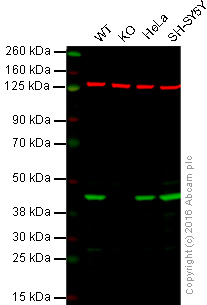 Western blot - Anti-Creatine kinase B type antibody [EPR3926] (AB108388), expandable thumbnail
