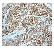 Immunohistochemistry (Formalin/PFA-fixed paraffin-embedded sections) - Anti-Creatine kinase B type antibody [EPR3926] - BSA and Azide free (AB239928)