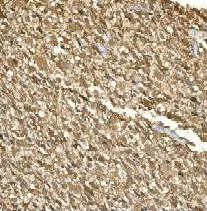 Immunohistochemistry (Formalin/PFA-fixed paraffin-embedded sections) - Anti-Creatine kinase B type antibody [EPR3927] (AB92452)