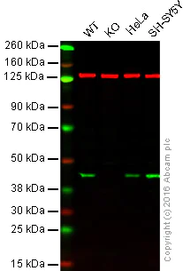 Western blot - Anti-Creatine kinase B type antibody [EPR3927] (AB92452)