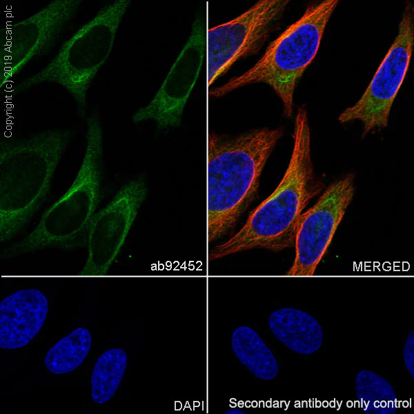 Immunocytochemistry/ Immunofluorescence - Anti-Creatine kinase B type antibody [EPR3927] - BSA and Azide free (AB247555)