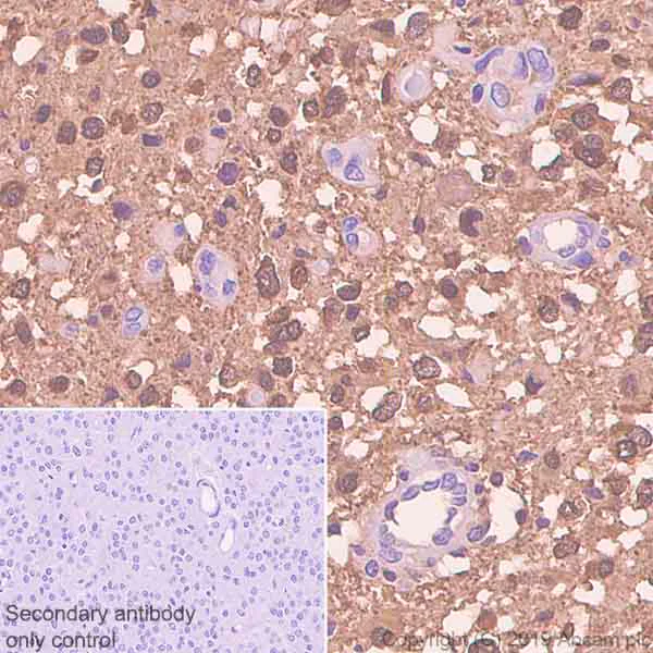 Immunohistochemistry (Formalin/PFA-fixed paraffin-embedded sections) - Anti-Creatine kinase B type antibody [EPR3927] - BSA and Azide free (AB247555)