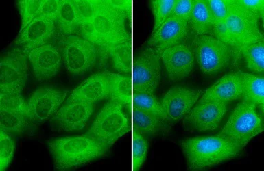 Immunocytochemistry/ Immunofluorescence - Anti-Creatine Kinase MM antibody (AB151465)