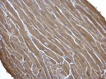Immunohistochemistry (Formalin/PFA-fixed paraffin-embedded sections) - Anti-Creatine Kinase MM antibody (AB151465)