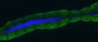 Immunohistochemistry - Anti-Creatine Kinase MM antibody (AB151465)
