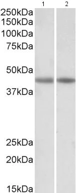 Western blot - Anti-Creatine Kinase MM antibody (AB174672)