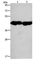 Western blot - Anti-Creatine Kinase MM antibody (AB198235)