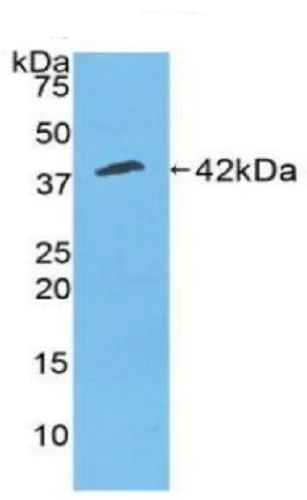 Western blot - Anti-Creatine Kinase MM antibody (AB231200)