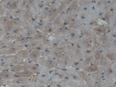 Immunohistochemistry (Formalin/PFA-fixed paraffin-embedded sections) - Anti-Creatine Kinase MM antibody (AB233201)