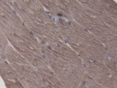 Immunohistochemistry (Formalin/PFA-fixed paraffin-embedded sections) - Anti-Creatine Kinase MM antibody (AB233201)