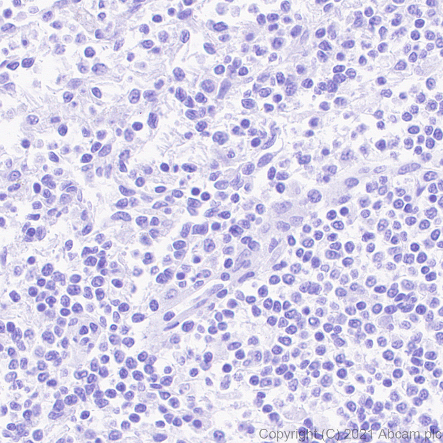 Immunohistochemistry (Formalin/PFA-fixed paraffin-embedded sections) - Anti-Creatine Kinase MM antibody [EPR25358-10] (ab283683), expandable thumbnail