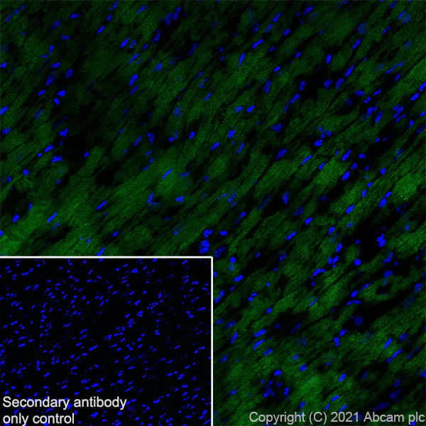 Immunohistochemistry (Frozen sections) - Anti-Creatine Kinase MM antibody [EPR25358-10] (AB283683)