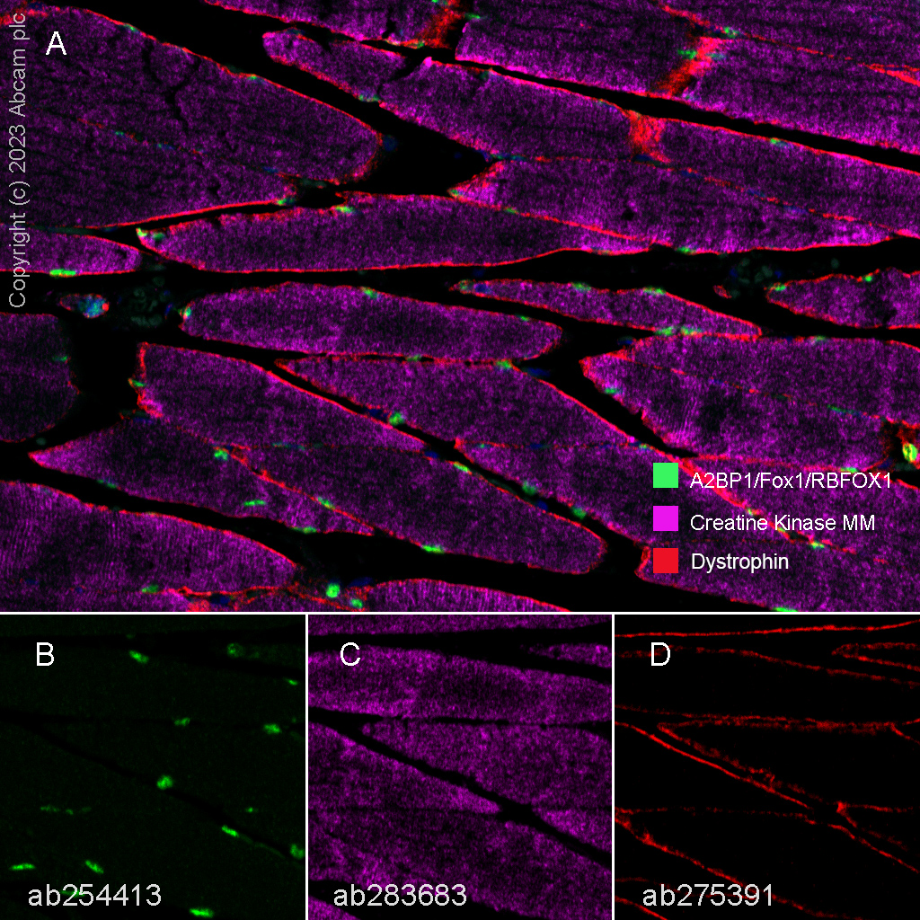 Multiplex immunohistochemistry - Anti-Creatine Kinase MM antibody [EPR25358-10] (ab283683), expandable thumbnail