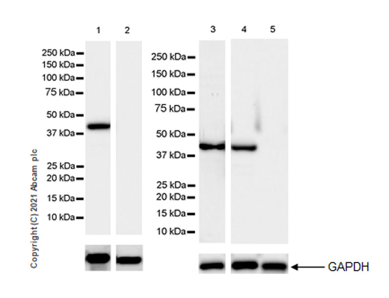 Western blot - Anti-Creatine Kinase MM antibody [EPR25358-10] (AB283683), expandable thumbnail