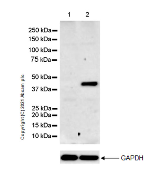 Western blot - Anti-Creatine Kinase MM antibody [EPR25358-10] (ab283683), expandable thumbnail