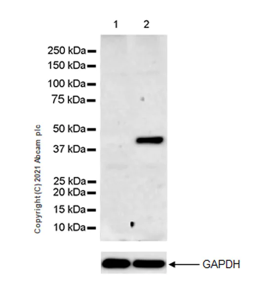 Western blot - Anti-Creatine Kinase MM antibody [EPR25358-10] (AB283683)