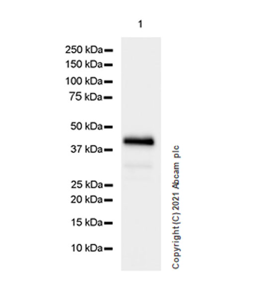 Western blot - Anti-Creatine Kinase MM antibody [EPR25358-10] (ab283683), expandable thumbnail