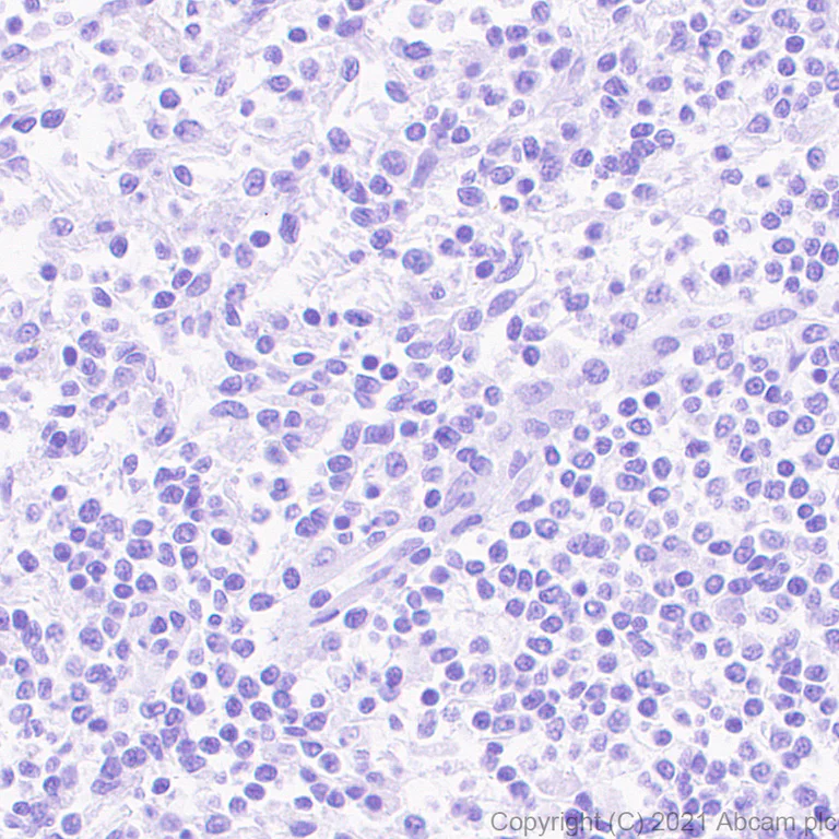 Immunohistochemistry (Formalin/PFA-fixed paraffin-embedded sections) - Anti-Creatine Kinase MM antibody [EPR25358-10] - BSA and Azide free (AB283711)