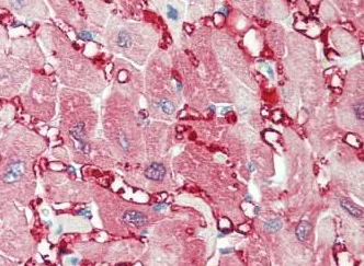 Immunohistochemistry (Formalin/PFA-fixed paraffin-embedded sections) - Anti-Creatine Kinase MM antibody - N-terminal (AB195664)
