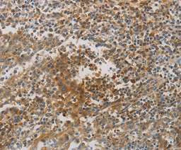 Immunohistochemistry (Formalin/PFA-fixed paraffin-embedded sections) - Anti-Creatine kinase MT antibody (AB198257)