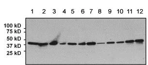 Western blot - Anti-CREB antibody [LB9] (AB178322)